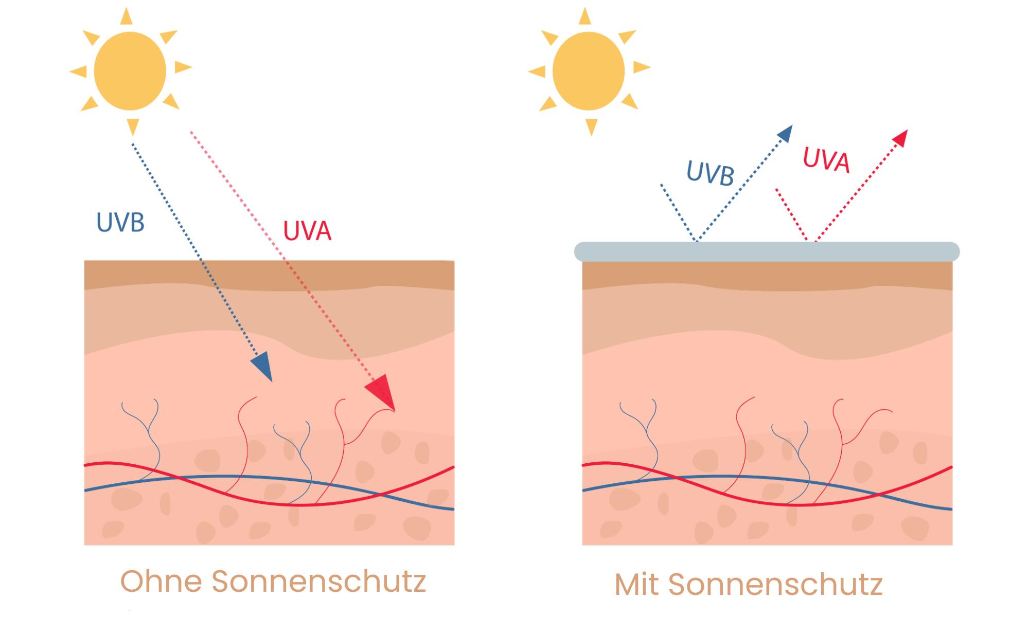 Illustration zum UV-Schutz der Haut: Vergleich zwischen unbehandelter Haut, in die UV-A- und UV-B-Strahlen eindringen, und Haut mit Sonnenschutz, bei der die Strahlen an der Oberfläche reflektiert werden.